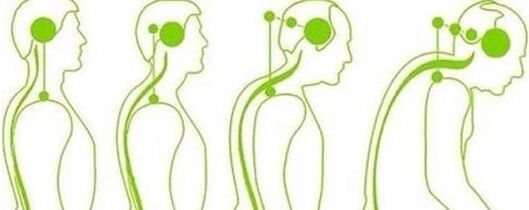 La columna cervical pierde movilidad
