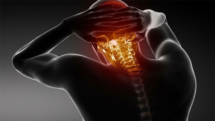 dolor en la parte posterior de la cabeza con osteocondrosis cervical